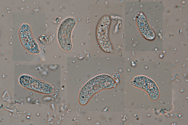 Macchie bianche su nocciolo (Exidiopsis calcea)